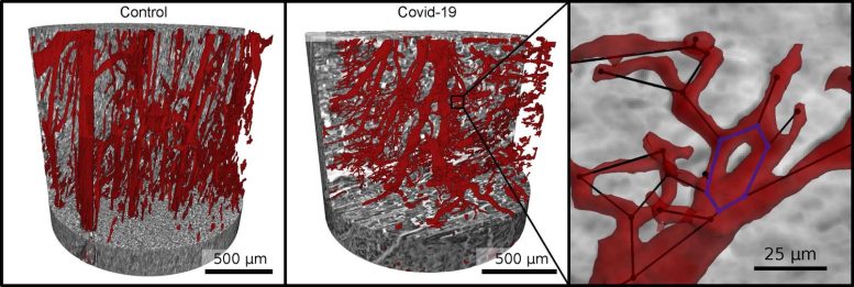 Heart-Tissue-Severe-COVID-19-777x261.jpg